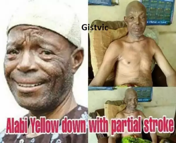 Veteran Yoruba Actor, Alabi Yellow, Has Stroke (Photo)